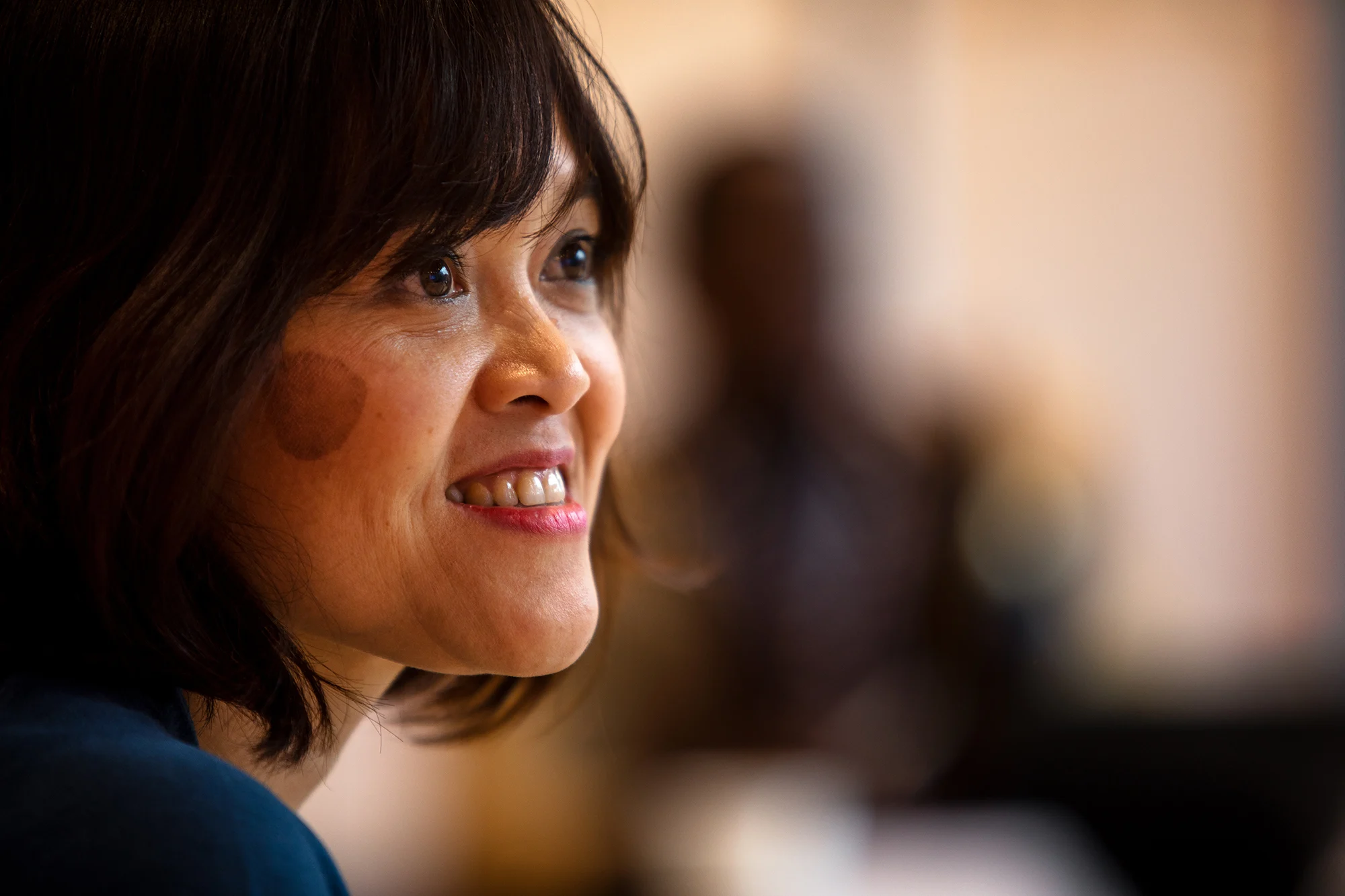 A close up photo of a woman with light neutral skin smiling with a birthmark on her cheek and brown chin length hair 