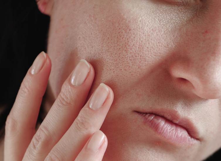 SkincarePielGrasa--inkafarma-blog-body-1