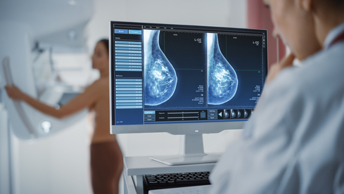 Cáncer de mama diagnóstico