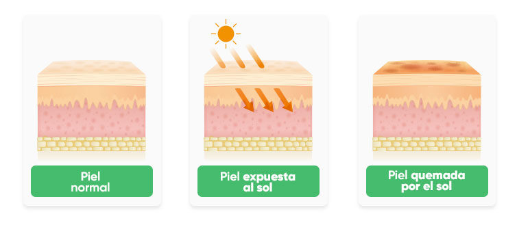 piel quemada explicacion blog