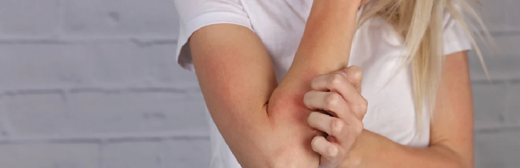 Irritated Skin Article image