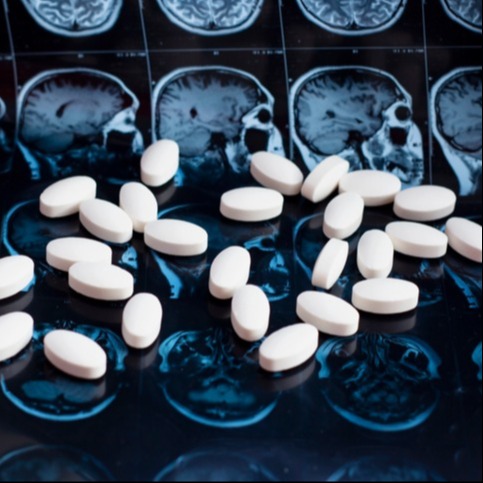 Head MRI and Migraine Prevention with Qulipta