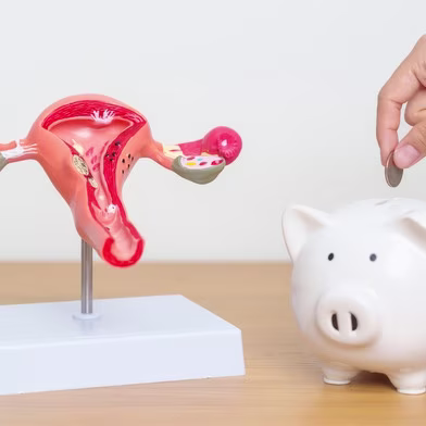 Uterus and Ovaries Model with Piggy Bank Symbolizing Economic Funds for Uninsured Clomid Drugs