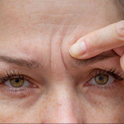 Understanding Fine Lines and Wrinkles