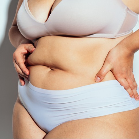 Cortisol and Body Shape