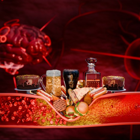 Foods That Raise Cholesterol and Harm Heart Health