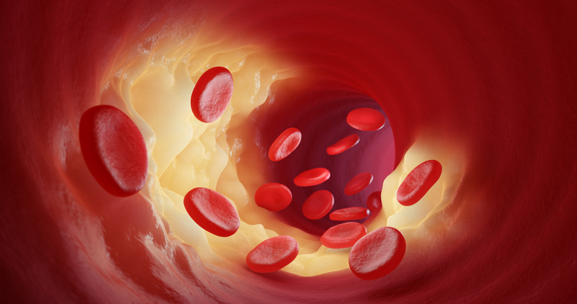 Red blood cells leak into the arteries 