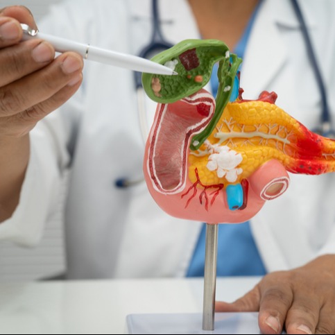 Gallstone Size and Treatment Decisions