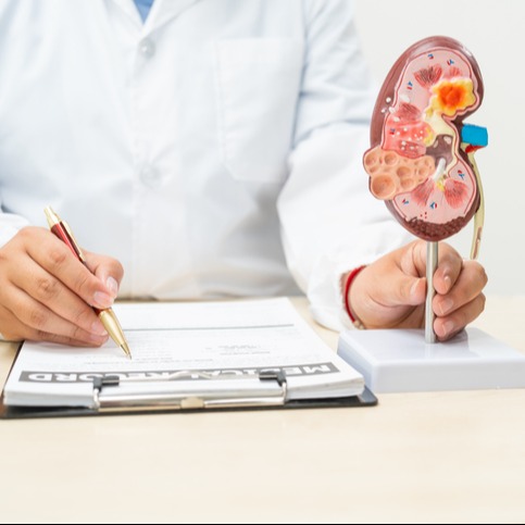 Doctor Discussing Polycystic Kidney Disease and Kidney Function