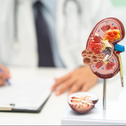 Doctor Examining Kidney Model for CKD Awareness