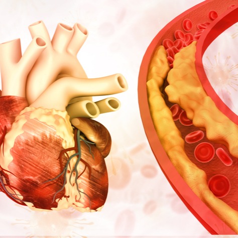 Repatha Side Effects and Safety Overview