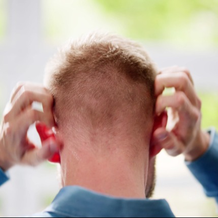 Itchy Scalp from Dryness and Irritation