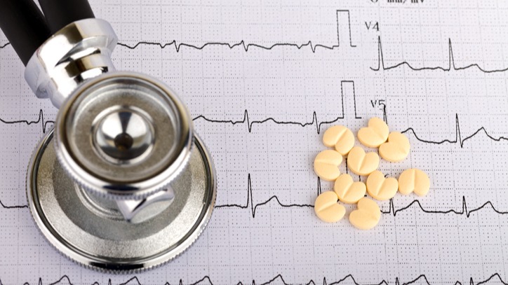 Electrocardiogram