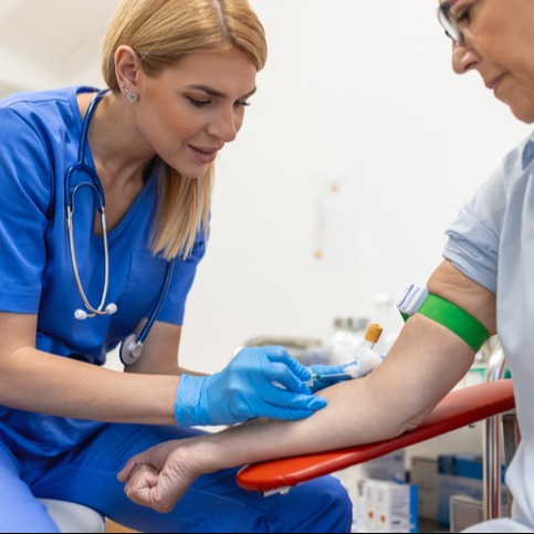 Routine Monitoring During Apixaban Therapy