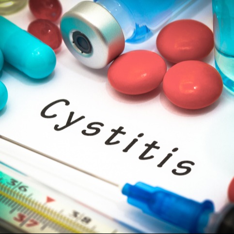 Cystitis Treatment Options: Oral and Intravesical Medications
