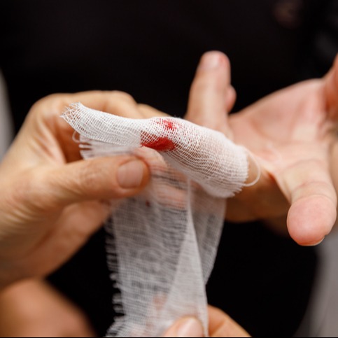 Managing Bleeding Risk on Apixaban