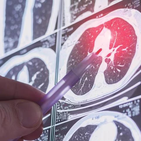 Chest CT image. Lung parenchyma. Disease of lungs.