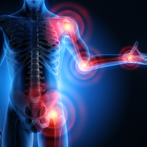 Joint Pain and Inflammation: Visualizing Rheumatoid Arthritis