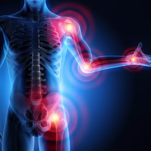 Joint Pain and Inflammation: Visualizing Rheumatoid Arthritis