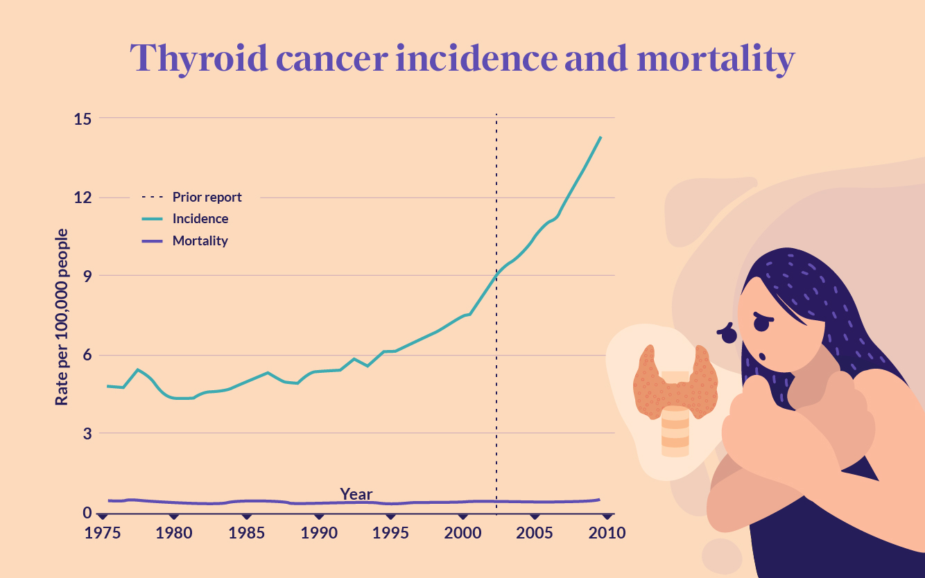 HealthMatch Surge in thyroid cancer cases may not only be due to