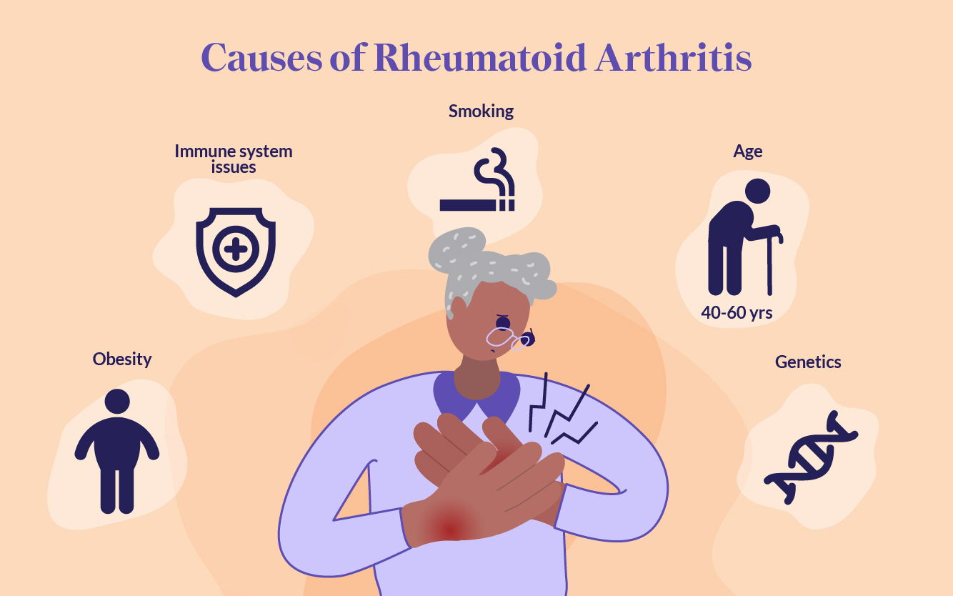 Debunking the Myths: How Much of Rheumatoid Arthritis is Genetic? - Myth: Rheumatoid arthritis is solely caused by genetics