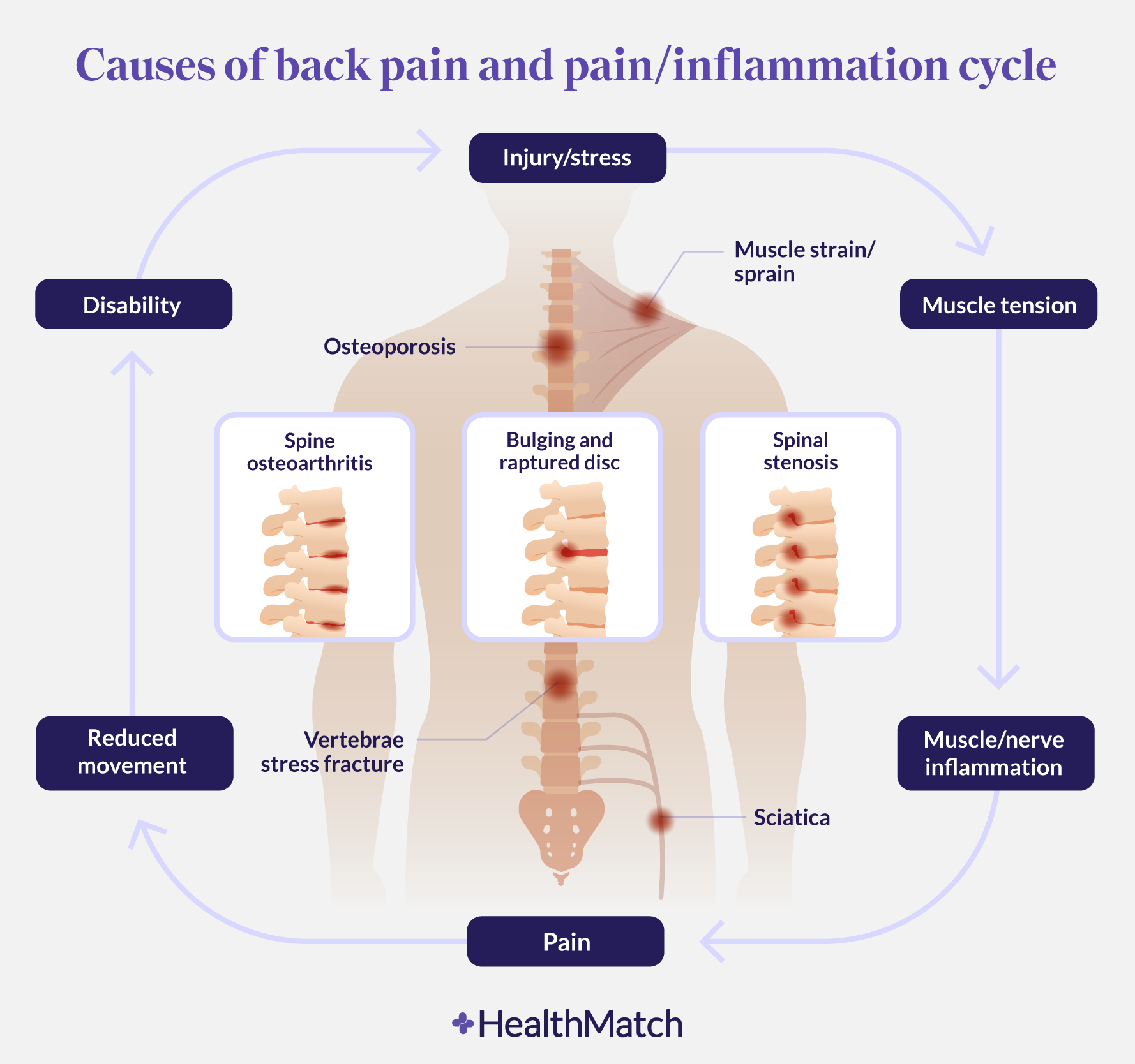 healthmatch-when-painkillers-make-back-pain-worse