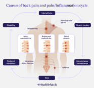 HealthMatch When Painkillers Make Back Pain Worse