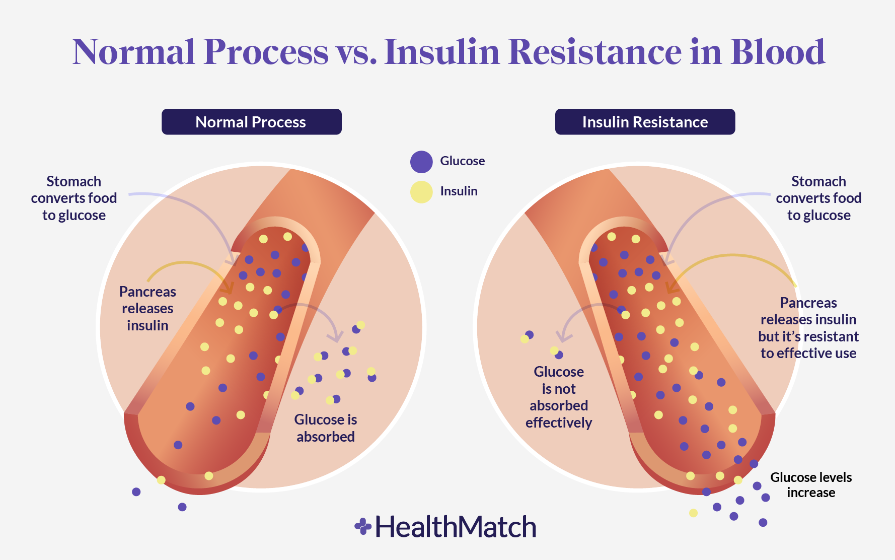 The Hidden Dangers Of Insulin Resistance