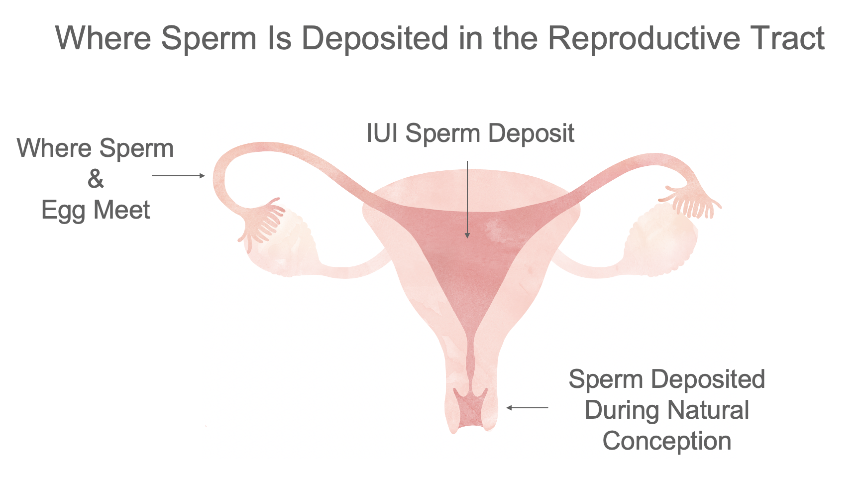 Basics of Conception and Fertility Treatment FertilityIQ