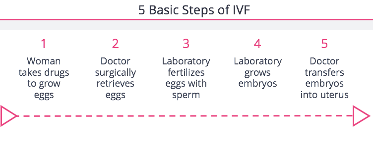 5 Steps of IVF