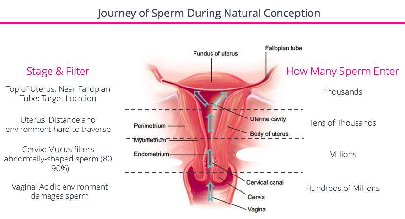 An Overview Of Iui Fertilityiq