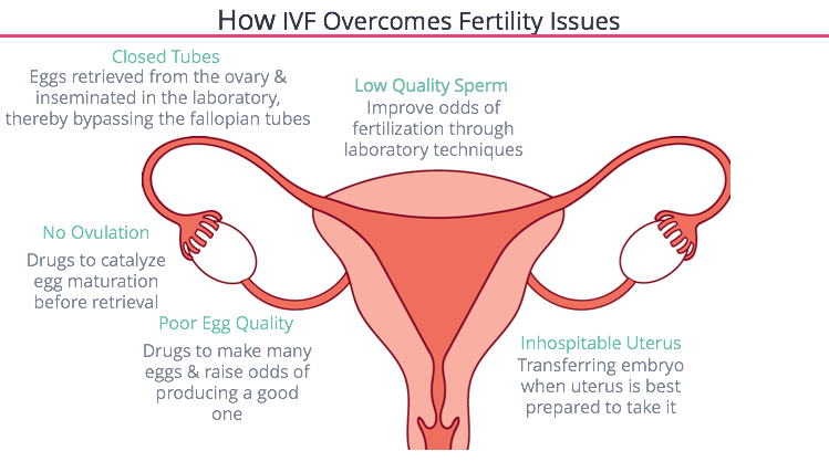 IVF Fixes of Natural Conception