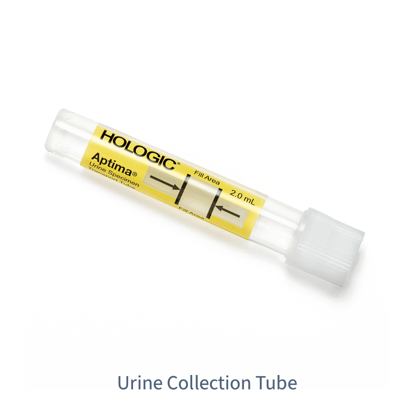 Yellow hologic collection tube  thumbnail image