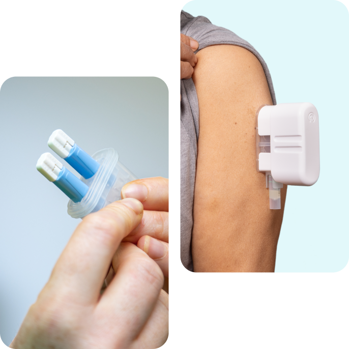 Collage showing a close-up of the medical device and a person using it on their arm. Collage showing a close-up of the medical device and a person using it on their arm.