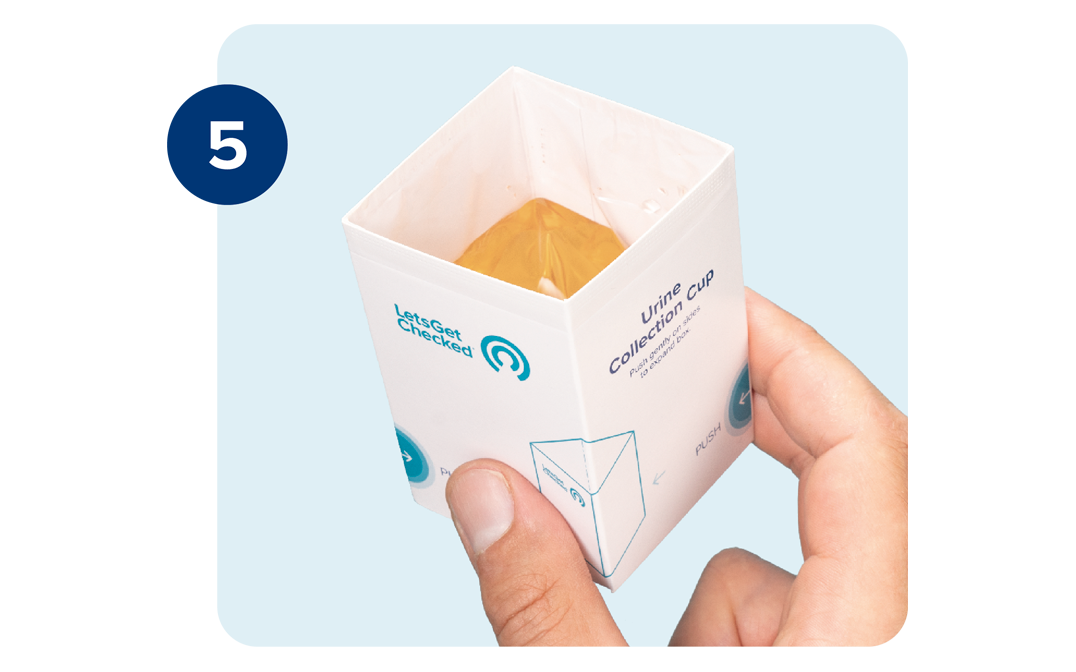 A right hand is shown holding a LetsGetChecked branded urine collection cup with urine sample. A right hand is shown holding a LetsGetChecked branded urine collection cup with urine sample.