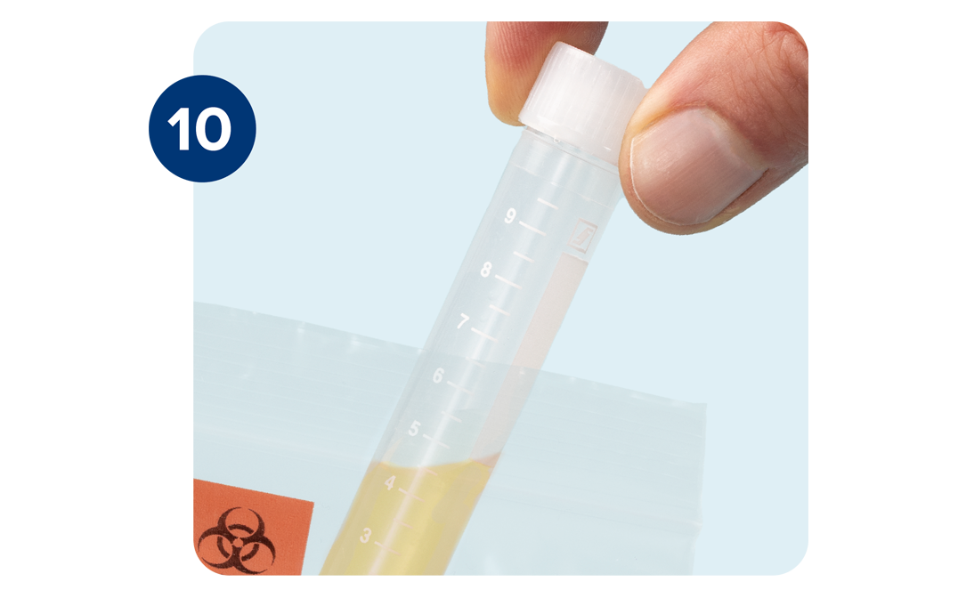 Right hand placing the closed urine sample tube into the biohazard bag. Right hand placing the closed urine sample tube into the biohazard bag.