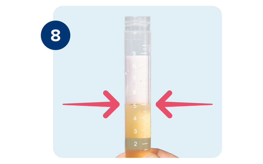 Two red arrows indicate that the urine line should reach the 5 milliliter mark on the tube. Two red arrows indicate that the urine line should reach the 5 milliliter mark on the tube.