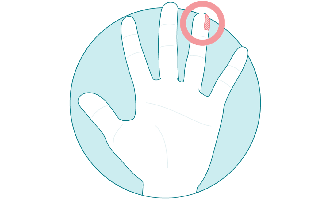 Illustration of a left hand with the side of tip of ring finger circled.