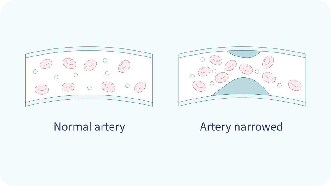 What is cholesterol? What is cholesterol?