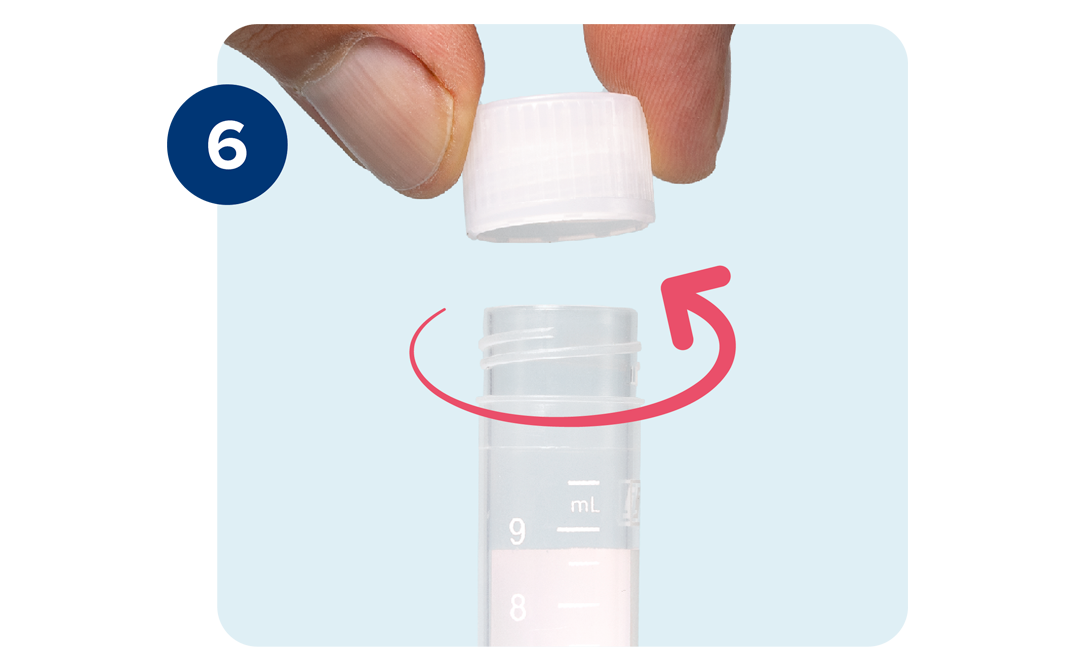 Urine sample tube cap being twisted open anticlockwise. Urine sample tube cap being twisted open anticlockwise.