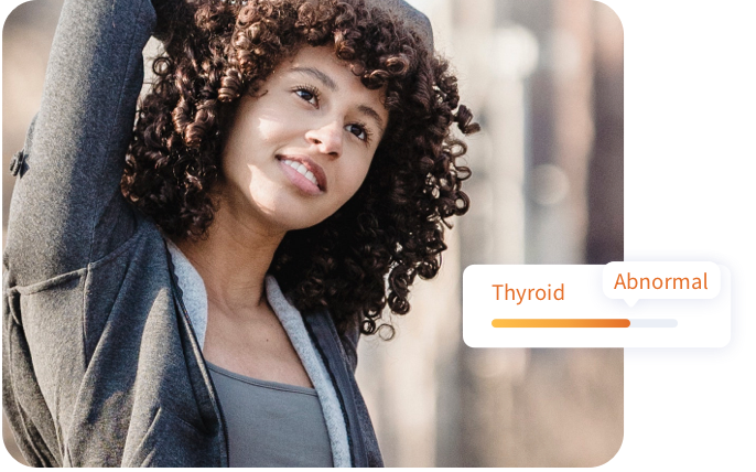 woman doing yoga with abnormal thyroid results