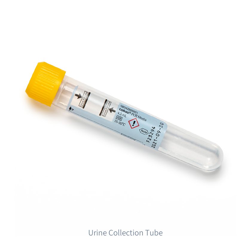 A urine sample collection tube with a yellow lid lies horizontally on a white background thumbnail image