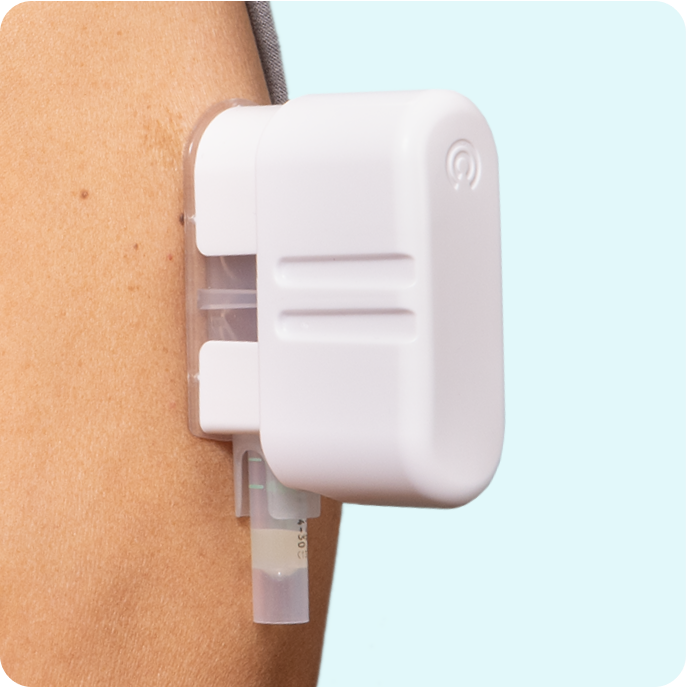Close-up of an ImPress device attached to an upper arm.
