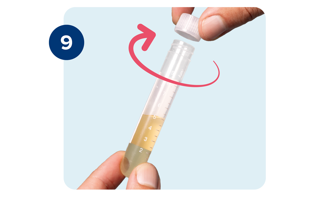 Left hand holds the urine sample tube as the right hand closes the cap clockwise. Left hand holds the urine sample tube as the right hand closes the cap clockwise.