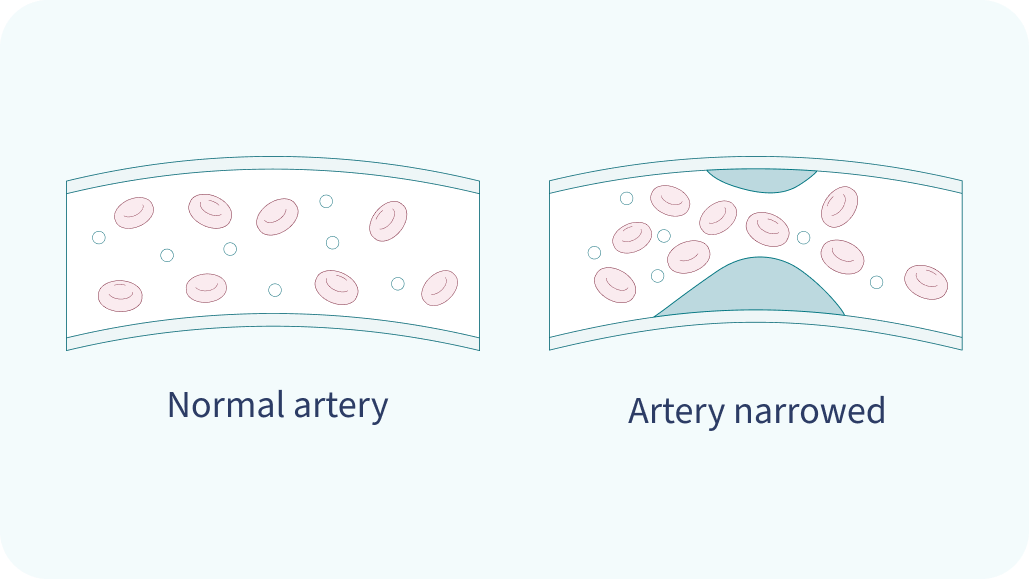 What is cholesterol? What is cholesterol?