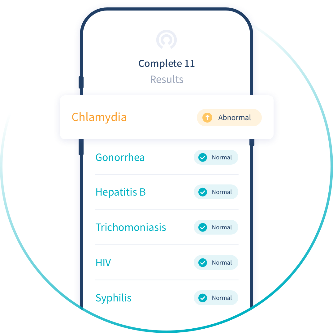 Smartphone screen displaying Complete 11 results dashboard.