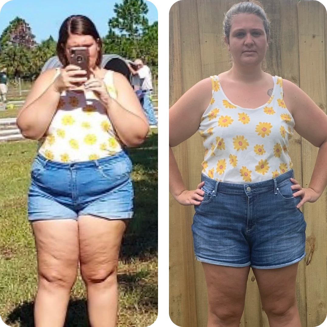 Side by side comparison showing Nicole before with more weight and after, Nicole with less weight. Side by side comparison showing Nicole before with more weight and after, Nicole with less weight.
