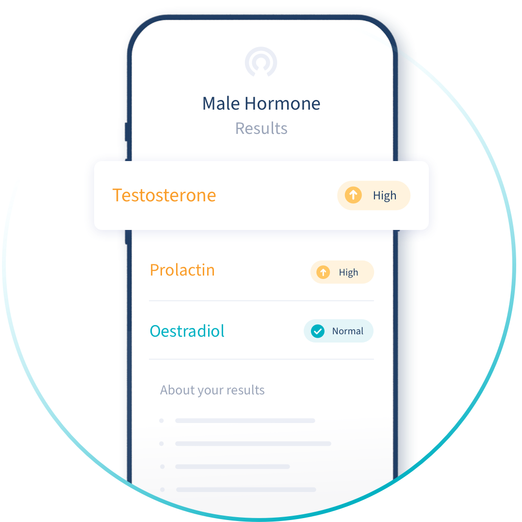 Male Hormone results image 