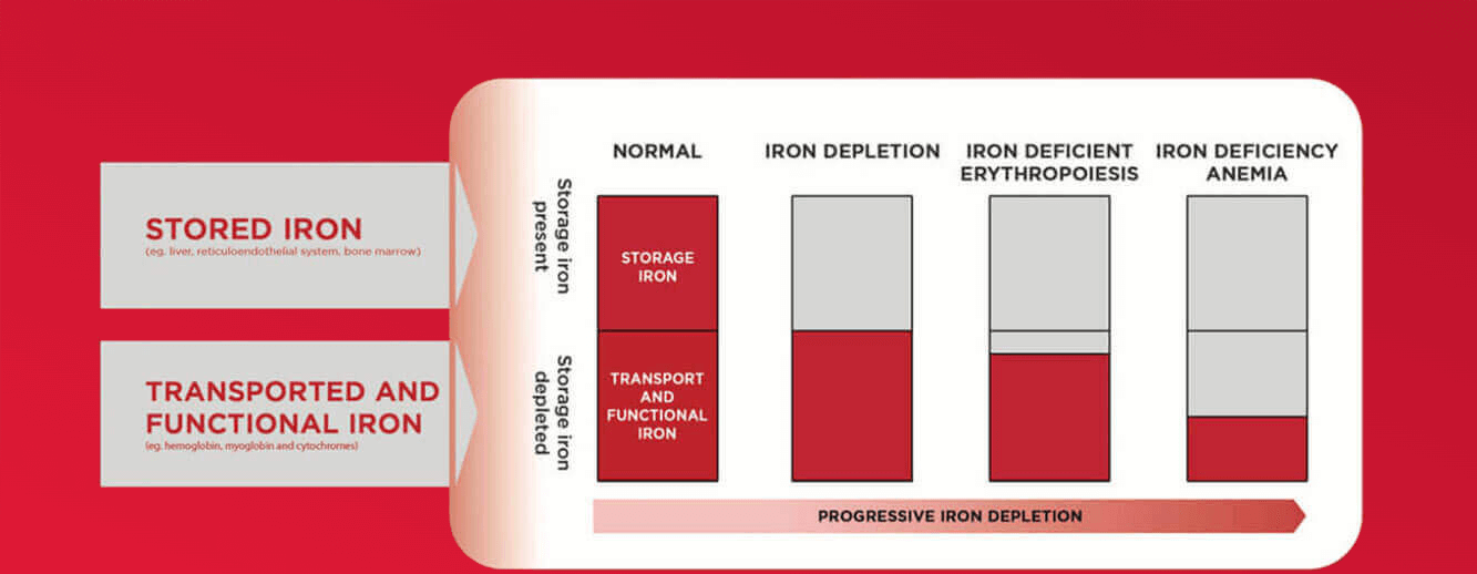 SPECTRUM OF IRON DEFICIENCY