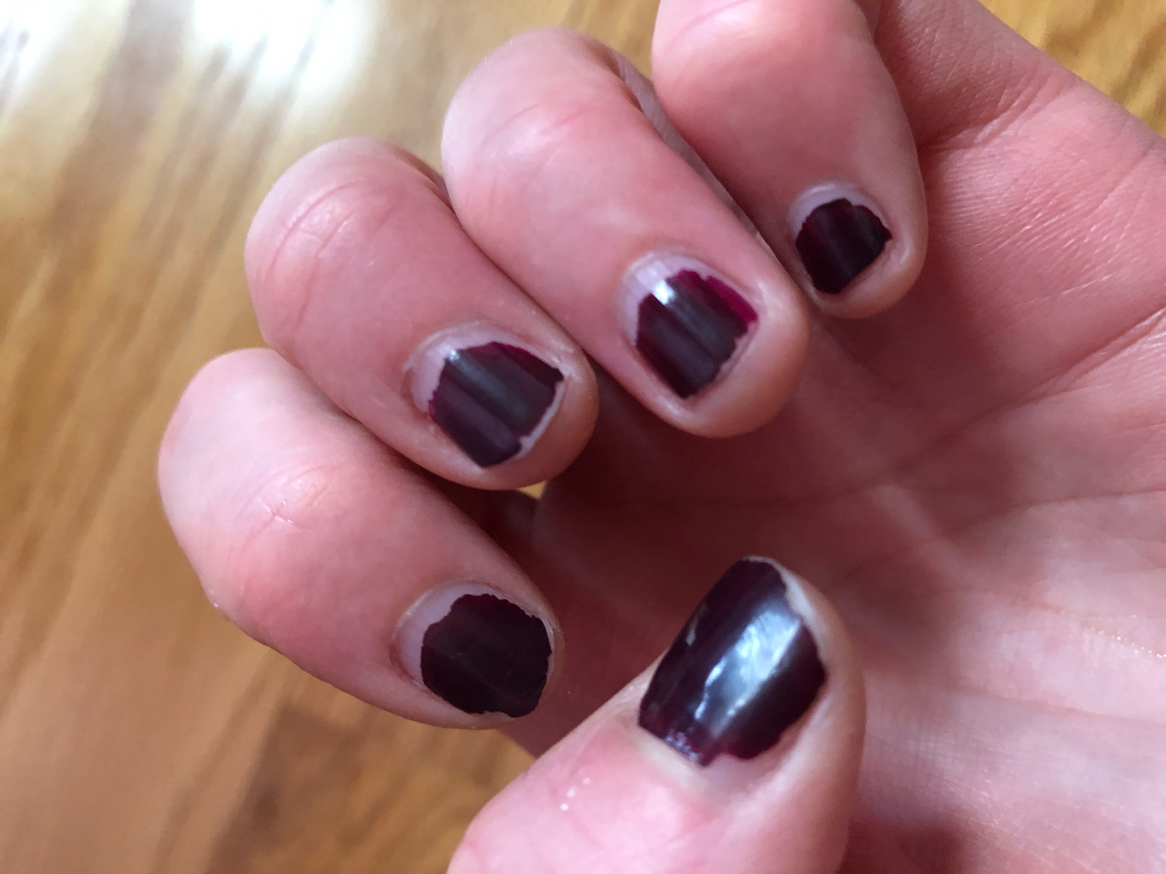 fingernails with grown-out nail polish